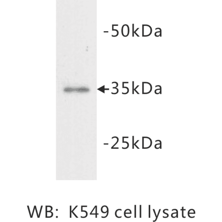 Western Blot - Anti-LDHA Antibody (BMA1029) - Antibodies.com