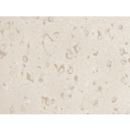 Immunohistochemistry - Anti-NETO1 Antibody (BMA1031) - Antibodies.com