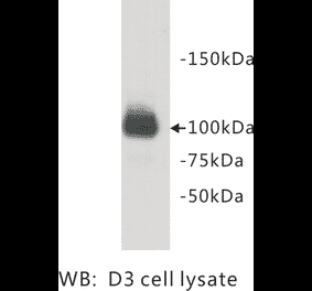 Western Blot - Anti-PGBD5 Antibody (BMA1035) - Antibodies.com
