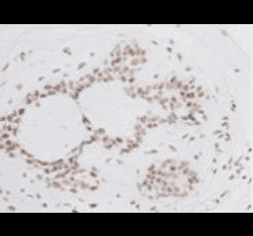 Immunohistochemistry - Anti-BMI1 Antibody (BMA1036) - Antibodies.com