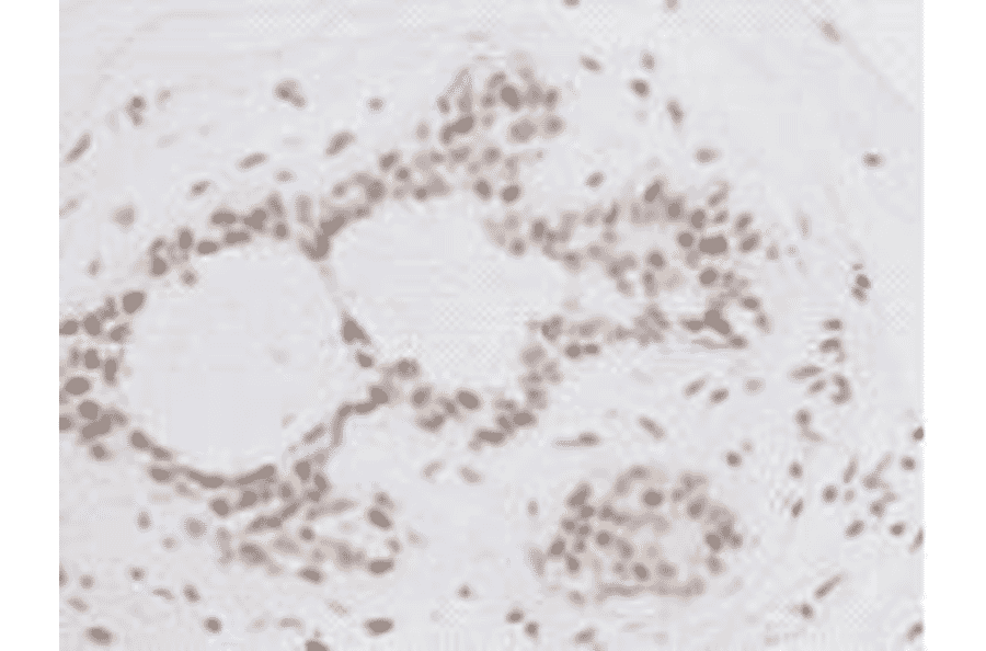 Immunohistochemistry - Anti-BMI1 Antibody (BMA1036) - Antibodies.com
