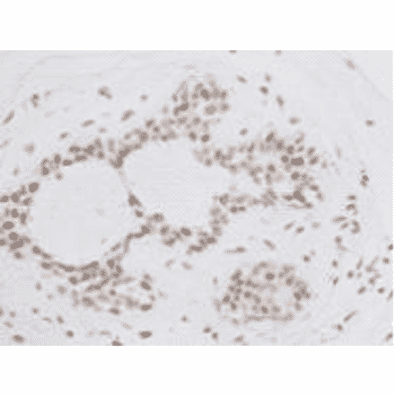 Immunohistochemistry - Anti-BMI1 Antibody (BMA1036) - Antibodies.com