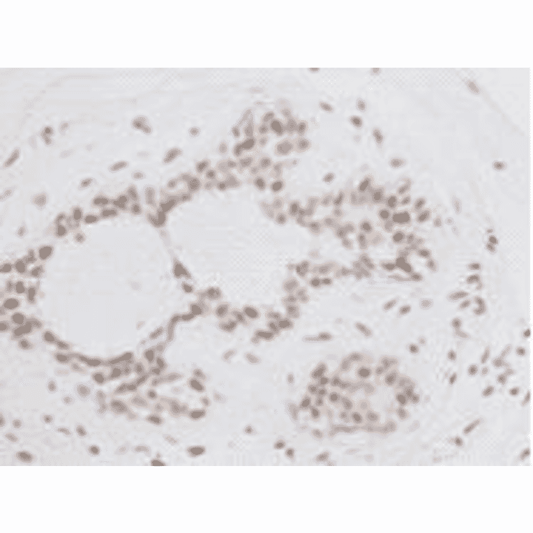 Immunohistochemistry - Anti-BMI1 Antibody (BMA1036) - Antibodies.com