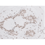 Immunohistochemistry - Anti-BMI1 Antibody (BMA1036) - Antibodies.com