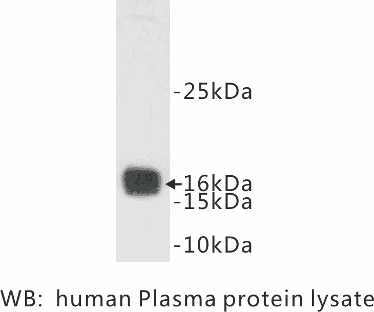 Western blot analysis using Anti-Prealbumin Antibody.