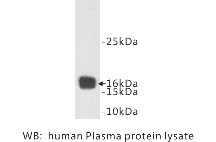 Western Blot - Anti-Prealbumin Antibody (BMA1037) - Antibodies.com
