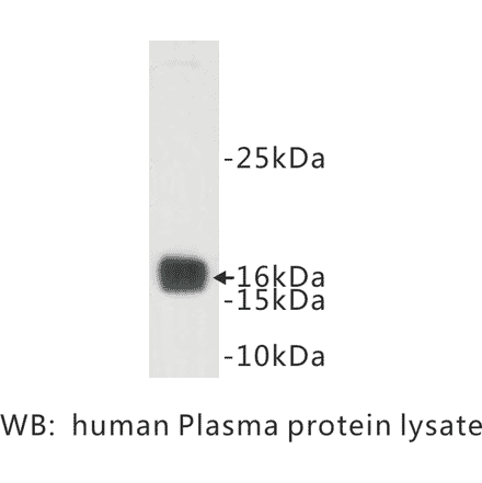 Western Blot - Anti-Prealbumin Antibody (BMA1037) - Antibodies.com