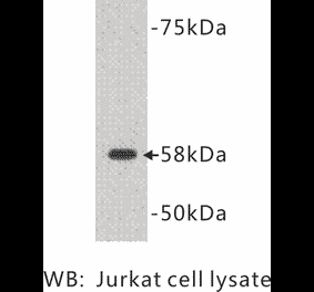 Western Blot - Anti-TDT Antibody (BMA1039) - Antibodies.com
