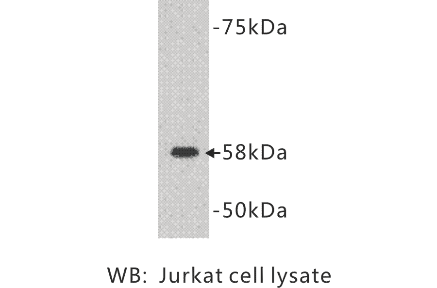 Western Blot - Anti-TDT Antibody (BMA1039) - Antibodies.com