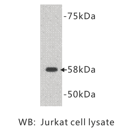 Western Blot - Anti-TDT Antibody (BMA1039) - Antibodies.com