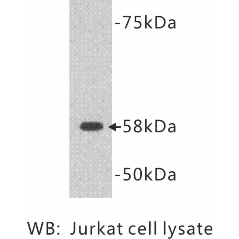 Western Blot - Anti-TDT Antibody (BMA1039) - Antibodies.com