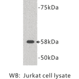 Western Blot - Anti-TDT Antibody (BMA1039) - Antibodies.com