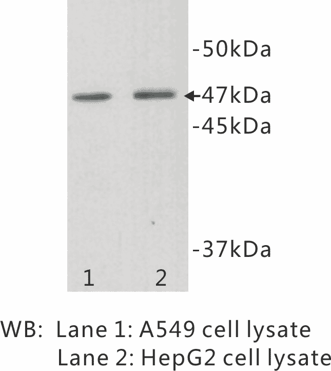 Western blot analysis using Anti-TMEM200A Antibody.