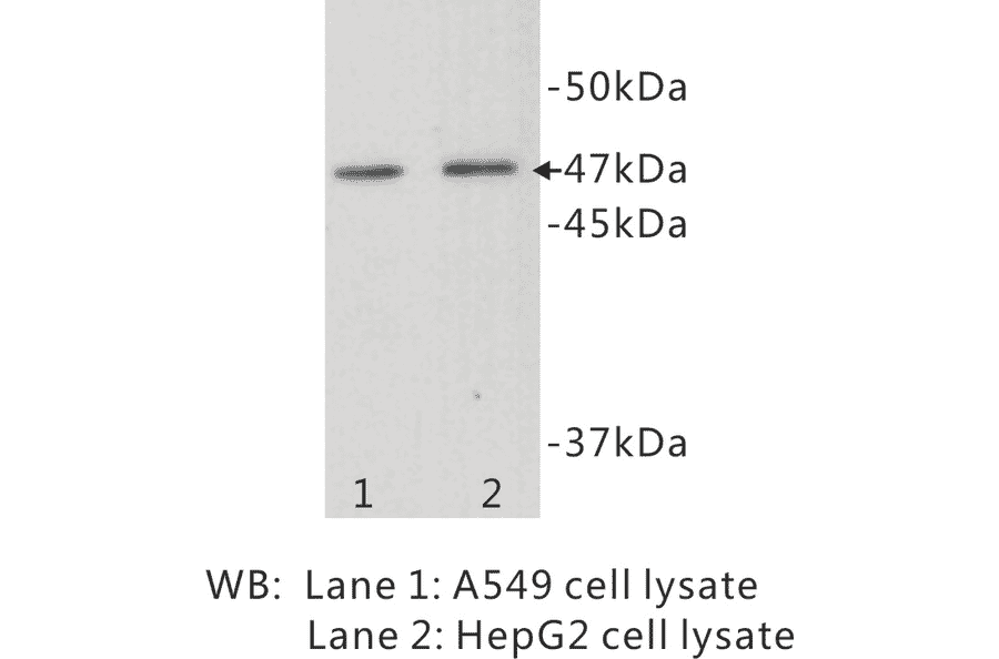 Western Blot - Anti-TMEM200A Antibody (BMA1041) - Antibodies.com