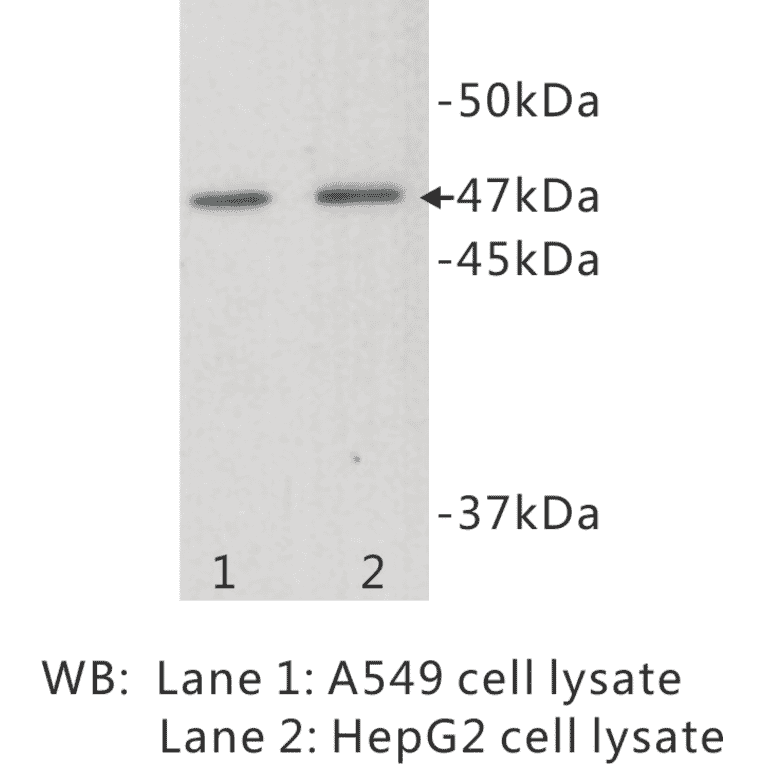 Western Blot - Anti-TMEM200A Antibody (BMA1041) - Antibodies.com