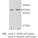 Western Blot - Anti-TMEM200A Antibody (BMA1041) - Antibodies.com