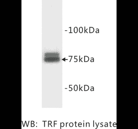 Western Blot - Anti-Transferrin Antibody (BMA1042) - Antibodies.com