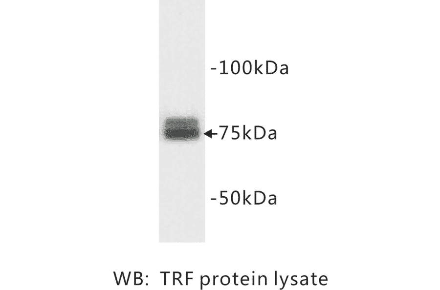 Western Blot - Anti-Transferrin Antibody (BMA1042) - Antibodies.com