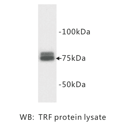Western Blot - Anti-Transferrin Antibody (BMA1042) - Antibodies.com