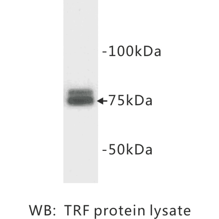 Western Blot - Anti-Transferrin Antibody (BMA1042) - Antibodies.com
