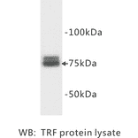 Western Blot - Anti-Transferrin Antibody (BMA1042) - Antibodies.com