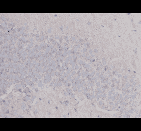 Immunohistochemistry - Anti-beta III Tubulin Antibody (BMA1045) - Antibodies.com