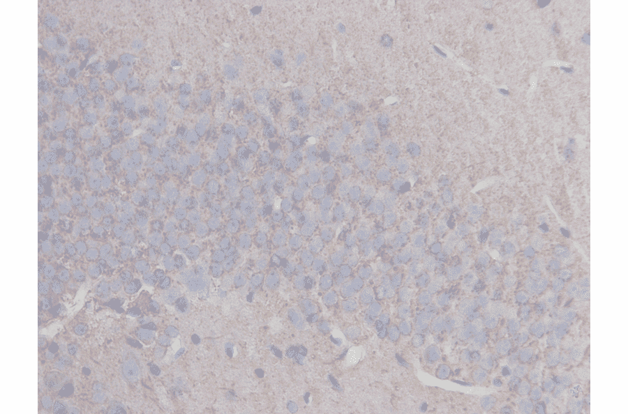 Immunohistochemistry - Anti-beta III Tubulin Antibody (BMA1045) - Antibodies.com