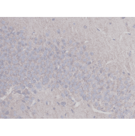 Immunohistochemistry - Anti-beta III Tubulin Antibody (BMA1045) - Antibodies.com