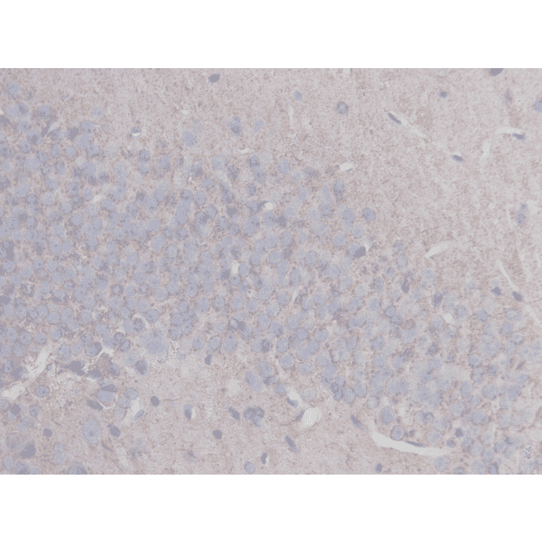 Immunohistochemistry - Anti-beta III Tubulin Antibody (BMA1045) - Antibodies.com