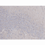 Immunohistochemistry - Anti-beta III Tubulin Antibody (BMA1045) - Antibodies.com