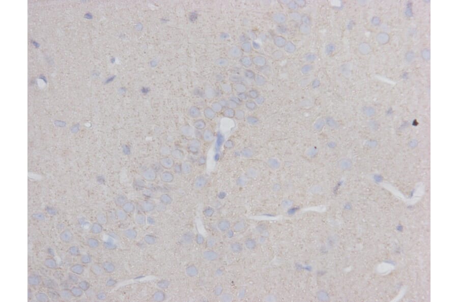 Immunohistochemistry - Anti-beta III Tubulin Antibody (BMA1045) - Antibodies.com