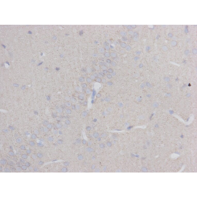 Immunohistochemistry - Anti-beta III Tubulin Antibody (BMA1045) - Antibodies.com
