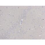 Immunohistochemistry - Anti-beta III Tubulin Antibody (BMA1045) - Antibodies.com