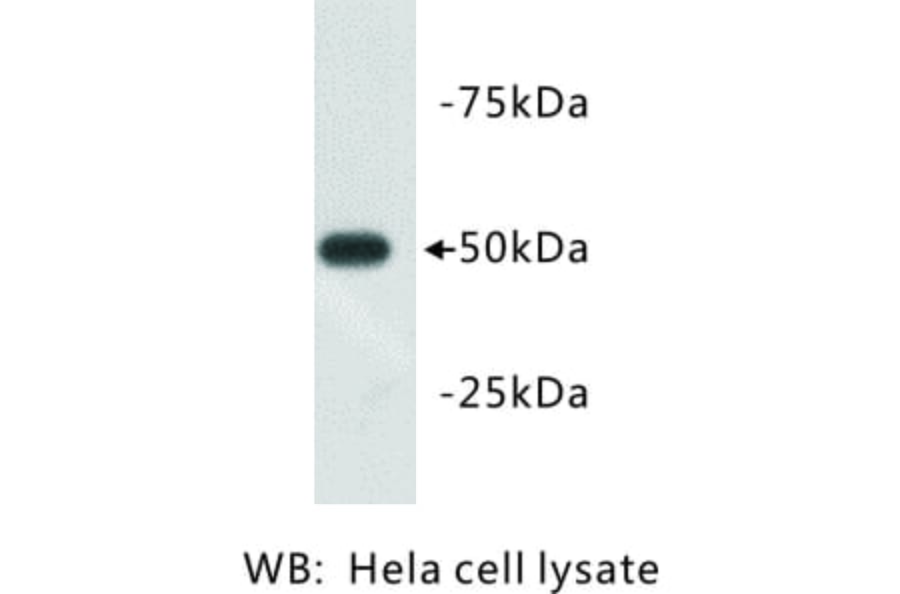 Western Blot - Anti-beta III Tubulin Antibody (BMA1045) - Antibodies.com