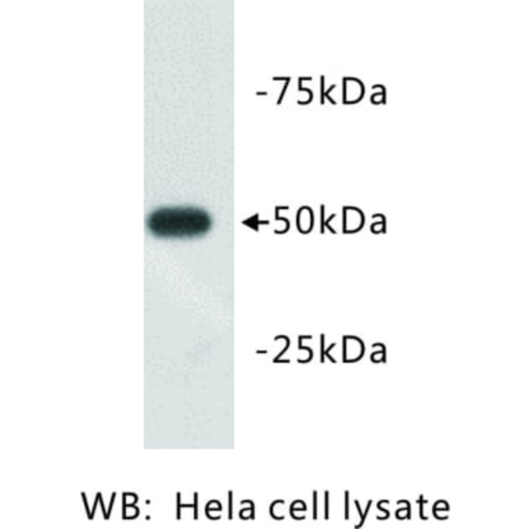 Western Blot - Anti-beta III Tubulin Antibody (BMA1045) - Antibodies.com