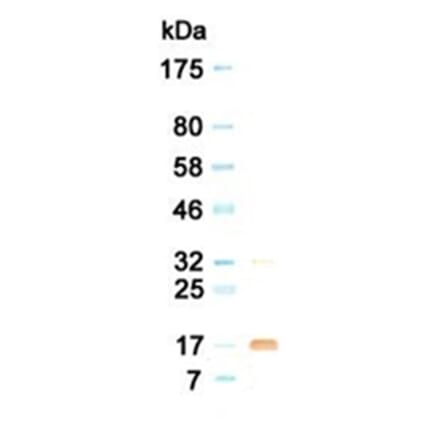 Western Blot - Anti-G-CSF Antibody (030516G02) - Antibodies.com