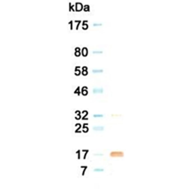 Western Blot - Anti-G-CSF Antibody (030516G02) - Antibodies.com