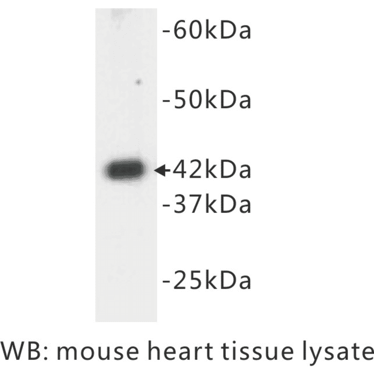 Western Blot - Anti-alpha Actin Antibody (BPA1002) - Antibodies.com