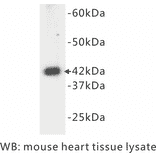 Western Blot - Anti-alpha Actin Antibody (BPA1002) - Antibodies.com