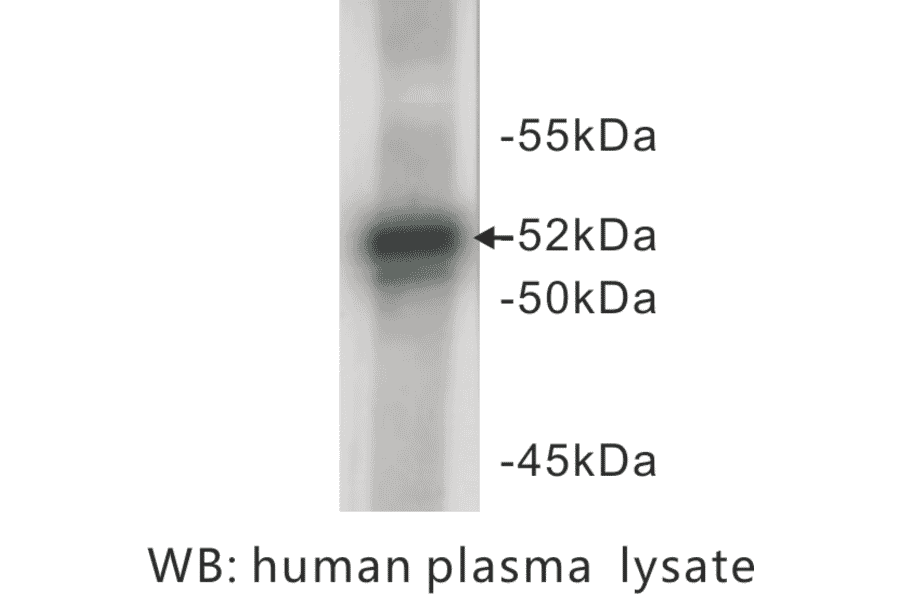 Western Blot - Anti-A1AT Antibody (BPA1003) - Antibodies.com