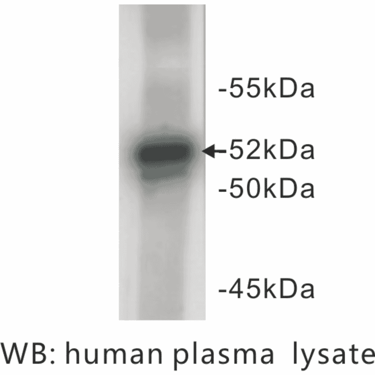 Western Blot - Anti-A1AT Antibody (BPA1003) - Antibodies.com