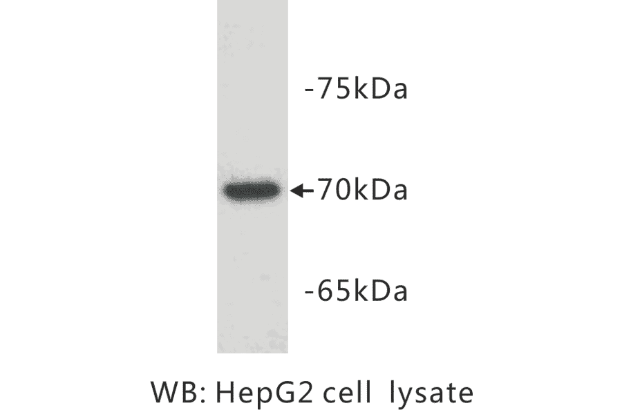 Western Blot - Anti-alpha Fetoprotein Antibody (BPA1004) - Antibodies.com