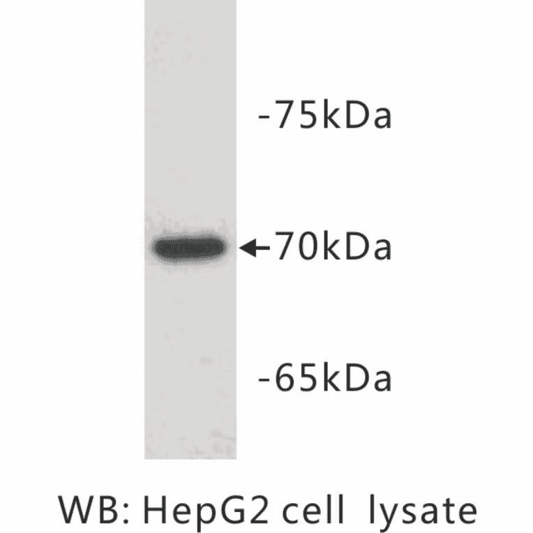 Western Blot - Anti-alpha Fetoprotein Antibody (BPA1004) - Antibodies.com