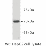 Western Blot - Anti-alpha Fetoprotein Antibody (BPA1004) - Antibodies.com