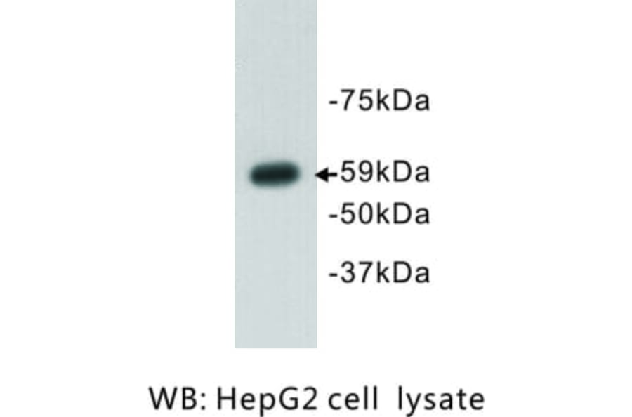 Western Blot - Anti-Aire Antibody (BPA1005) - Antibodies.com