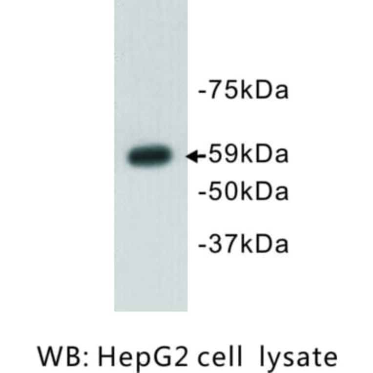 Western Blot - Anti-Aire Antibody (BPA1005) - Antibodies.com