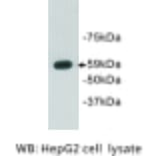 Western Blot - Anti-Aire Antibody (BPA1005) - Antibodies.com