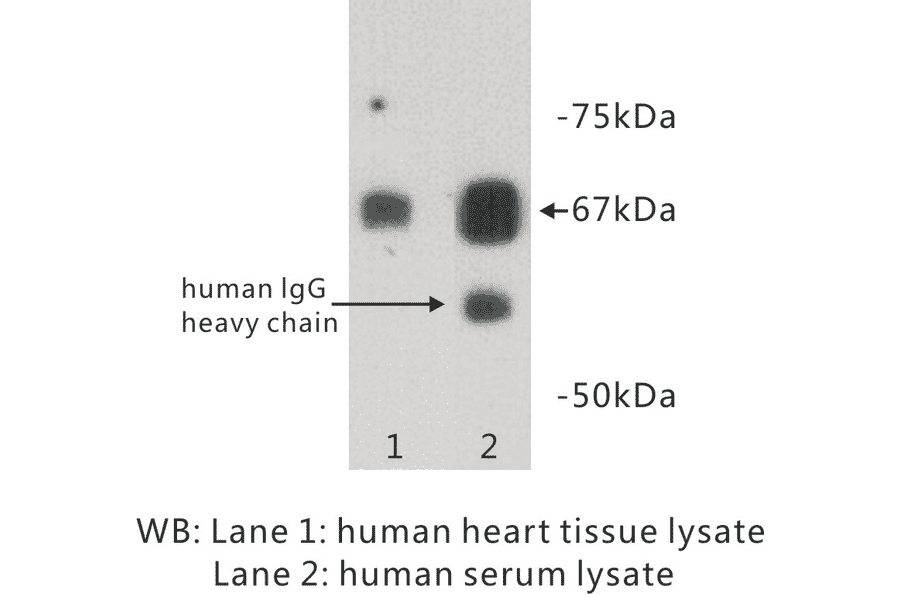 Western Blot - Anti-Albumin Antibody (BPA1006) - Antibodies.com