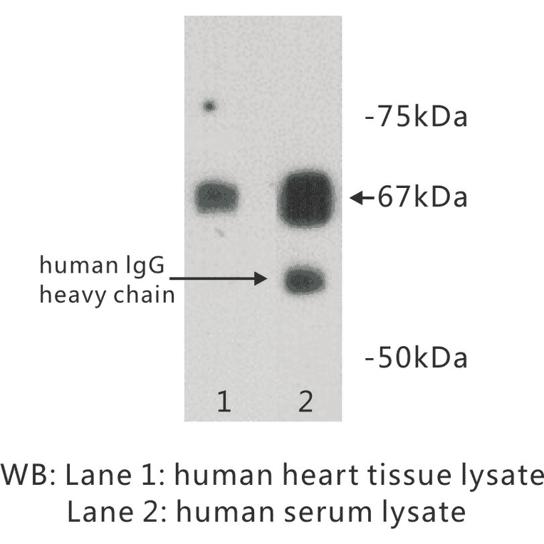 Western Blot - Anti-Albumin Antibody (BPA1006) - Antibodies.com