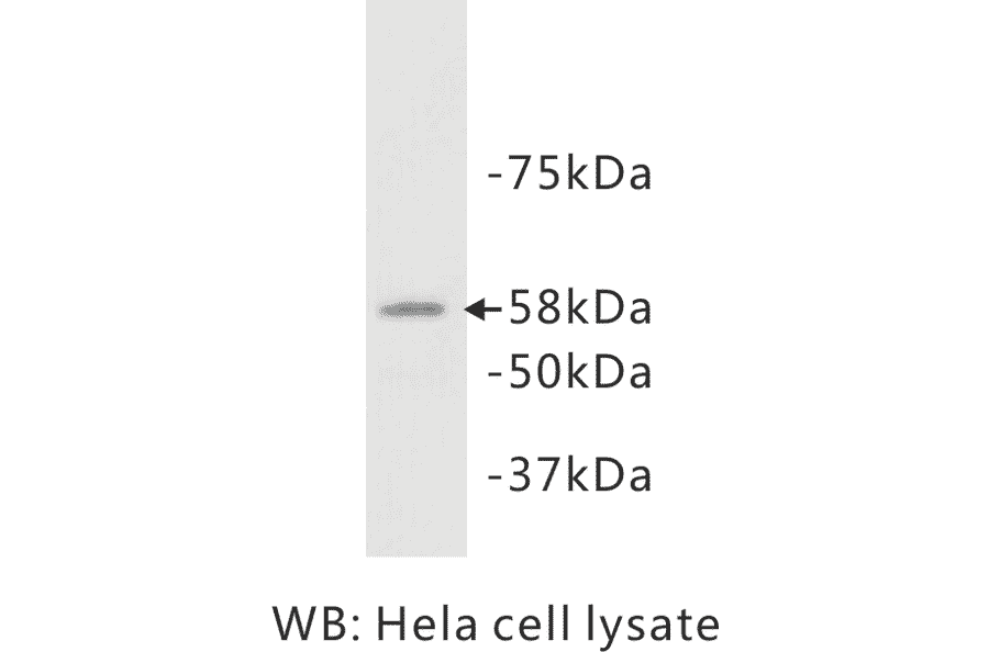 Western Blot - Anti-ALAP Antibody (BPA1007) - Antibodies.com